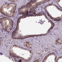 E-Cadherin Antibody (CL1170), Novus Biologicals 0.1mL; Unlabeled:Antibodies,