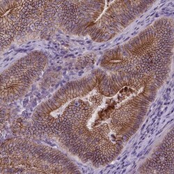 E-Cadherin Antibody (CL1170), Novus Biologicals 0.1mL; Unlabeled:Antibodies,
