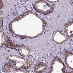 E-Cadherin Antibody (CL1172), Novus Biologicals 0.1mL; Unlabeled:Antibodies,