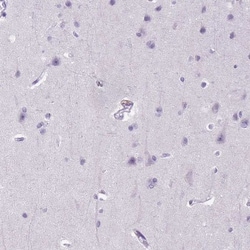 E-Cadherin Antibody (CL1172), Novus Biologicals 0.1mL; Unlabeled:Antibodies,