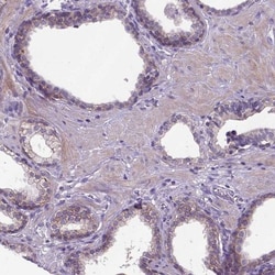 E-Cadherin Antibody (CL1180), Novus Biologicals 25 &mu;L, Unlabeled:Antibodies,