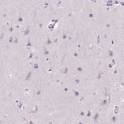 E-Cadherin Antibody (CL1180), Novus Biologicals 25 &mu;L, Unlabeled:Antibodies,