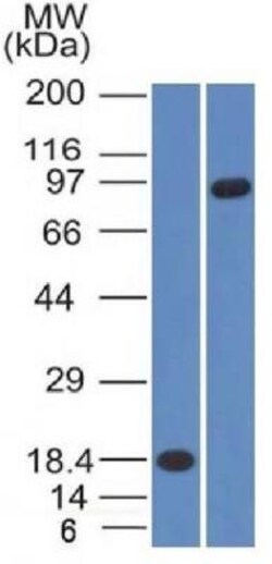 Mouse anti-E-Cadherin, Clone: CDH1/1121 + CDH1/1122, Novus Biologicals