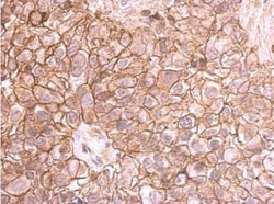 E-Cadherin Antibody, Novus Biologicals 0.1mL; Unlabeled:Antibodies, Polyclonal