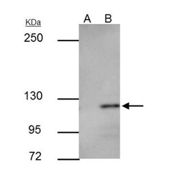 E-Cadherin Antibody, Novus Biologicals 0.1mL; Unlabeled:Antibodies, Polyclonal