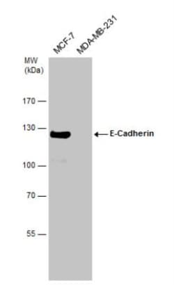 E-Cadherin Antibody, Novus Biologicals 0.1mL; Unlabeled:Antibodies, Polyclonal