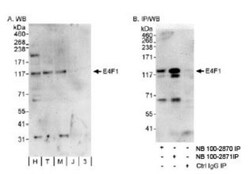E4F1 Antibody, Novus Biologicals 0.1mL; Unlabeled:Antibodies, Polyclonal
