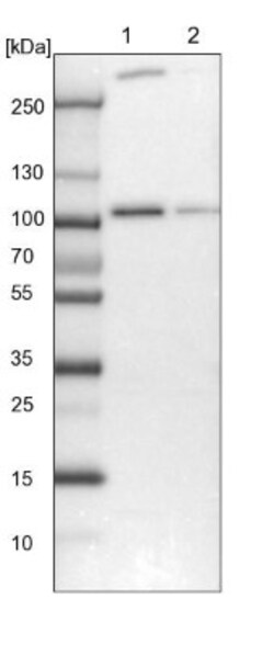 E6AP/UBE3A Antibody, Novus Biologicals:Antibodies:Primary Antibodies
