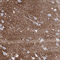 EAAT1/GLAST-1/SLC1A3 Antibody, Novus Biologicals 25 &mu;L; Unlabeled:Antibodies,