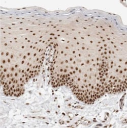 EBNA1BP2 Antibody, Novus Biologicals:Antibodies:Primary Antibodies