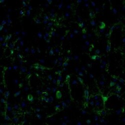 ECH1 Antibody, Novus Biologicals 0.1mL; Unlabeled:Antibodies, Polyclonal