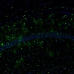ECH1 Antibody, Novus Biologicals 0.1mL; Unlabeled:Antibodies, Polyclonal