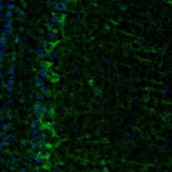 ECH1 Antibody, Novus Biologicals 0.1mL; Unlabeled:Antibodies, Polyclonal