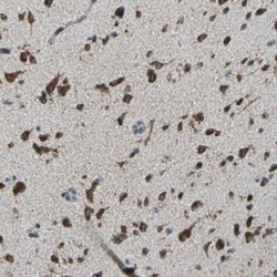ECH1 Antibody, Novus Biologicals 0.1mL; Unlabeled:Antibodies, Polyclonal