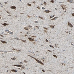 ECH1 Antibody, Novus Biologicals 0.1mL; Unlabeled:Antibodies, Polyclonal