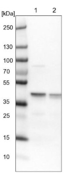 ECH1 Antibody, Novus Biologicals 0.1mL; Unlabeled:Antibodies, Polyclonal