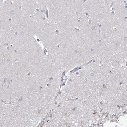 ECHDC3 Antibody, Novus Biologicals:Antibodies:Primary Antibodies