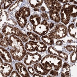 ECHDC3 Antibody, Novus Biologicals:Antibodies:Primary Antibodies