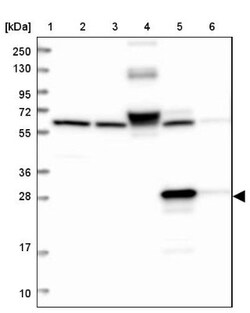 ECHDC3 Antibody, Novus Biologicals:Antibodies:Primary Antibodies