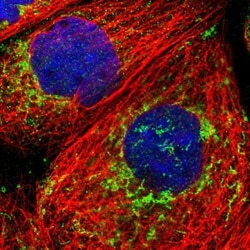 ECHS1 Antibody, Novus Biologicals 0.1mL; Unlabeled:Antibodies, Polyclonal