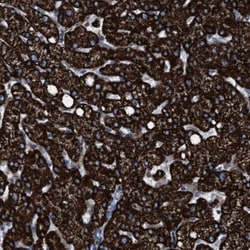 ECHS1 Antibody, Novus Biologicals 25 &mu;L | Buy Online | Novus Biologicals | Fisher Scientific