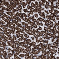 ECHS1 Antibody, Novus Biologicals 0.1mL; Unlabeled:Antibodies, Polyclonal
