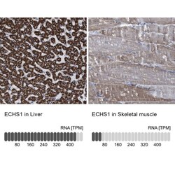 ECHS1 Antibody, Novus Biologicals 0.1mL; Unlabeled:Antibodies, Polyclonal