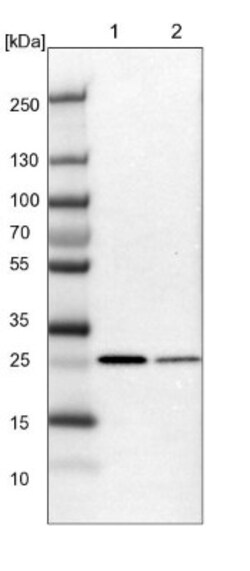 ECHS1 Antibody, Novus Biologicals 0.1mL; Unlabeled:Antibodies, Polyclonal