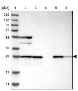 ECHS1 Antibody, Novus Biologicals 0.1mL; Unlabeled:Antibodies, Polyclonal