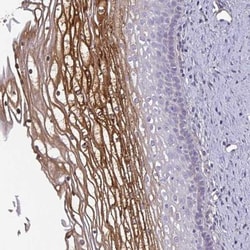 ECM-1/Secretory Component P85 Antibody, Novus Biologicals 0.1mL; Unlabeled:Antibodies,