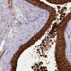 ECM-1/Secretory Component P85 Antibody, Novus Biologicals 0.1mL; Unlabeled:Antibodies,