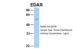 EDAR Antibody, Novus Biologicals 0.05mg; Unlabeled:Antibodies, Polyclonal