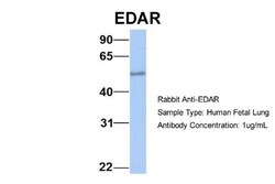 EDAR Antibody, Novus Biologicals 0.05mg; Unlabeled:Antibodies, Polyclonal