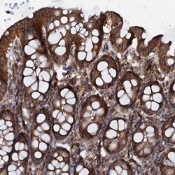 EDC4 Antibody, Novus Biologicals 0.1mL; Unlabeled:Antibodies, Polyclonal