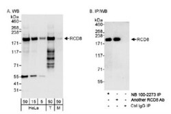 EDC4 Antibody, Novus Biologicals 0.1mL; Unlabeled:Antibodies, Polyclonal