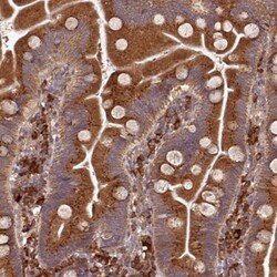 EDEM2 Antibody, Novus Biologicals 0.1mL; Unlabeled:Antibodies, Polyclonal
