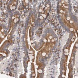 EDEM3 Antibody, Novus Biologicals:Antibodies:Primary Antibodies