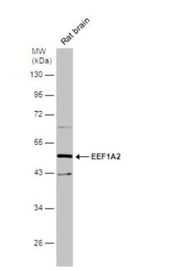 EEF1A2 Antibody, Novus Biologicals 0.1mg; Unlabeled:Antibodies, Polyclonal