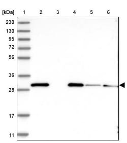EEF1B2 Antibody, Novus Biologicals 0.1mL; Unlabeled:Antibodies, Polyclonal