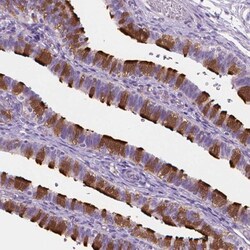 EFCAB1 Antibody, Novus Biologicals:Antibodies:Primary Antibodies