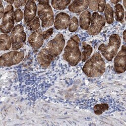 EFCAB2 Antibody, Novus Biologicals:Antibodies:Primary Antibodies