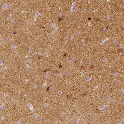 EFCBP2 Antibody, Novus Biologicals 0.1mL; Unlabeled:Antibodies, Polyclonal
