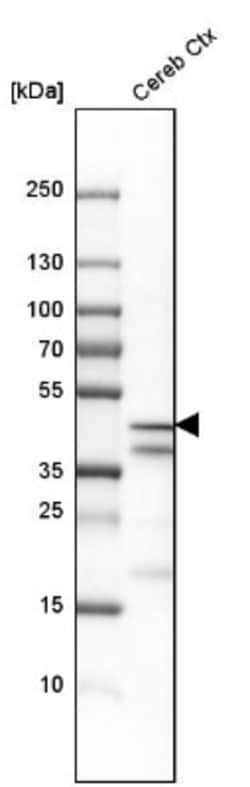 EFCBP2 Antibody, Novus Biologicals 0.1mL; Unlabeled:Antibodies, Polyclonal