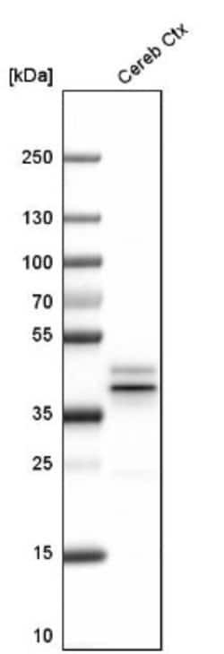 EFCBP2 Antibody, Novus Biologicals 0.1mL; Unlabeled:Antibodies, Polyclonal