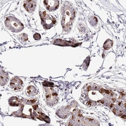 EFHD1 Antibody, Novus Biologicals 25 &mu;L, Unlabeled:Antibodies, Polyclonal