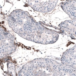 EFHD1 Antibody, Novus Biologicals 25 &mu;L, Unlabeled:Antibodies, Polyclonal