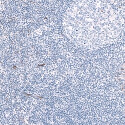 EFHD1 Antibody, Novus Biologicals 25 &mu;L, Unlabeled:Antibodies, Polyclonal
