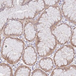 EFHD1 Antibody, Novus Biologicals:Antibodies:Primary Antibodies