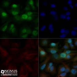 EGR2 Antibody - BSA Free, Novus Biologicals 0.025mg; Unlabeled:Antibodies,
