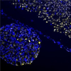 EGR2 Antibody - BSA Free, Novus Biologicals:Antibodies:Primary Antibodies
